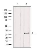 BCL-2 Antibody in Western Blot (WB)