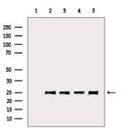 BCL-2 Antibody in Western Blot (WB)