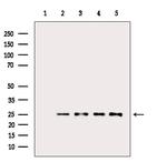 BCL-2 Antibody in Western Blot (WB)