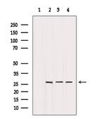 BCL-2 Antibody in Western Blot (WB)