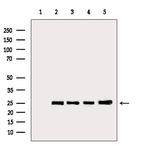 BCL-2 Antibody in Western Blot (WB)