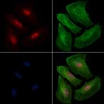 BIRC3 Antibody in Immunocytochemistry (ICC/IF)