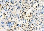 BIRC3 Antibody in Immunohistochemistry (Paraffin) (IHC (P))