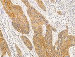 BRUCE Antibody in Immunohistochemistry (Paraffin) (IHC (P))