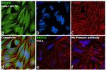 BNIP3L Antibody in Immunocytochemistry (ICC/IF)