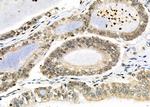 BNIP3L Antibody in Immunohistochemistry (Paraffin) (IHC (P))