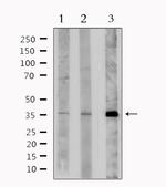 BNIP3L Antibody in Western Blot (WB)