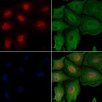 BUB1 Antibody in Immunocytochemistry (ICC/IF)