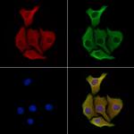 CTRP2 Antibody in Immunocytochemistry (ICC/IF)