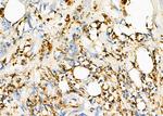 CTRP2 Antibody in Immunohistochemistry (Paraffin) (IHC (P))