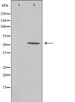 ZNHIT6 Antibody in Western Blot (WB)