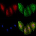 CACNA2D1 Antibody in Immunocytochemistry (ICC/IF)