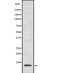 CGRP Antibody in Western Blot (WB)