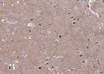 CaMKII alpha/delta Antibody in Immunohistochemistry (Paraffin) (IHC (P))