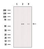 CaMKII delta Antibody in Western Blot (WB)