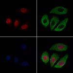 CASC5 Antibody in Immunocytochemistry (ICC/IF)