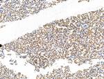 CASC5 Antibody in Immunohistochemistry (Paraffin) (IHC (P))