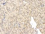 CASC5 Antibody in Immunohistochemistry (Paraffin) (IHC (P))