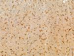 CASC5 Antibody in Immunohistochemistry (Paraffin) (IHC (P))