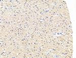 CASC5 Antibody in Immunohistochemistry (Paraffin) (IHC (P))