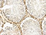 CASC5 Antibody in Immunohistochemistry (Paraffin) (IHC (P))