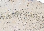 CK1 alpha Antibody in Immunohistochemistry (Paraffin) (IHC (P))