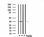 CK1 alpha Antibody in Western Blot (WB)