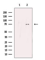 SLC7A1 Antibody in Western Blot (WB)