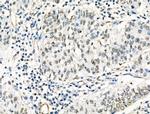 HP1 beta Antibody in Immunohistochemistry (Paraffin) (IHC (P))