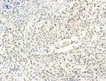 HP1 beta Antibody in Immunohistochemistry (Paraffin) (IHC (P))