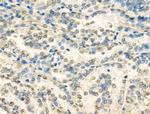 HP1 beta Antibody in Immunohistochemistry (Paraffin) (IHC (P))