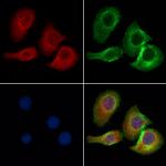 CBX7 Antibody in Immunocytochemistry (ICC/IF)