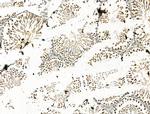 CBX7 Antibody in Immunohistochemistry (Paraffin) (IHC (P))