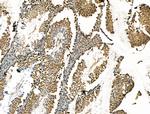 CBX7 Antibody in Immunohistochemistry (Paraffin) (IHC (P))