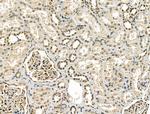 CBX7 Antibody in Immunohistochemistry (Paraffin) (IHC (P))