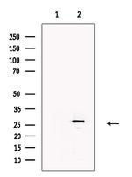 CBX7 Antibody in Western Blot (WB)