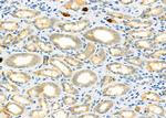 CD26 Antibody in Immunohistochemistry (Paraffin) (IHC (P))