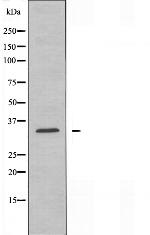 CD32 Antibody in Western Blot (WB)