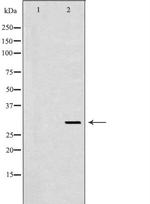 CD154 (CD40 Ligand) Antibody in Western Blot (WB)