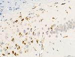 CD44 Antibody in Immunohistochemistry (Paraffin) (IHC (P))