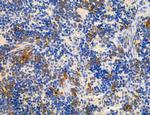 CD44 Antibody in Immunohistochemistry (Paraffin) (IHC (P))