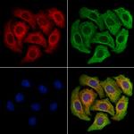 CD64 Antibody in Immunocytochemistry (ICC/IF)