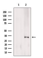 CD64 Antibody in Western Blot (WB)