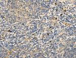 CD83 Antibody in Immunohistochemistry (Paraffin) (IHC (P))