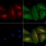 CDK5RAP3 Antibody in Immunocytochemistry (ICC/IF)