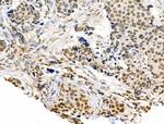 CDK8 Antibody in Immunohistochemistry (Paraffin) (IHC (P))