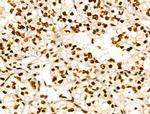 CDK8 Antibody in Immunohistochemistry (Paraffin) (IHC (P))