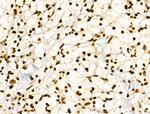 CDK8 Antibody in Immunohistochemistry (Paraffin) (IHC (P))