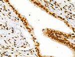 CDK8 Antibody in Immunohistochemistry (Paraffin) (IHC (P))