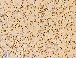 CDK8 Antibody in Immunohistochemistry (Paraffin) (IHC (P))